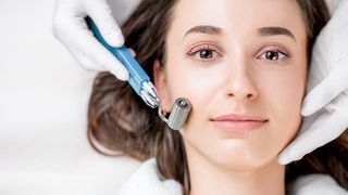 Microneedling Behandlung im Gesicht einer Frau im Kosmetikstudio