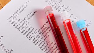 Blutröhrchen und Testergebnisse