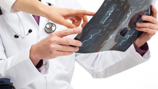 Ärzte betrachten ein Röntgenbild