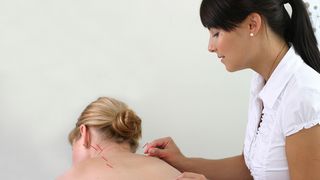 Ärztin führt Akupunktur an Patientin durch