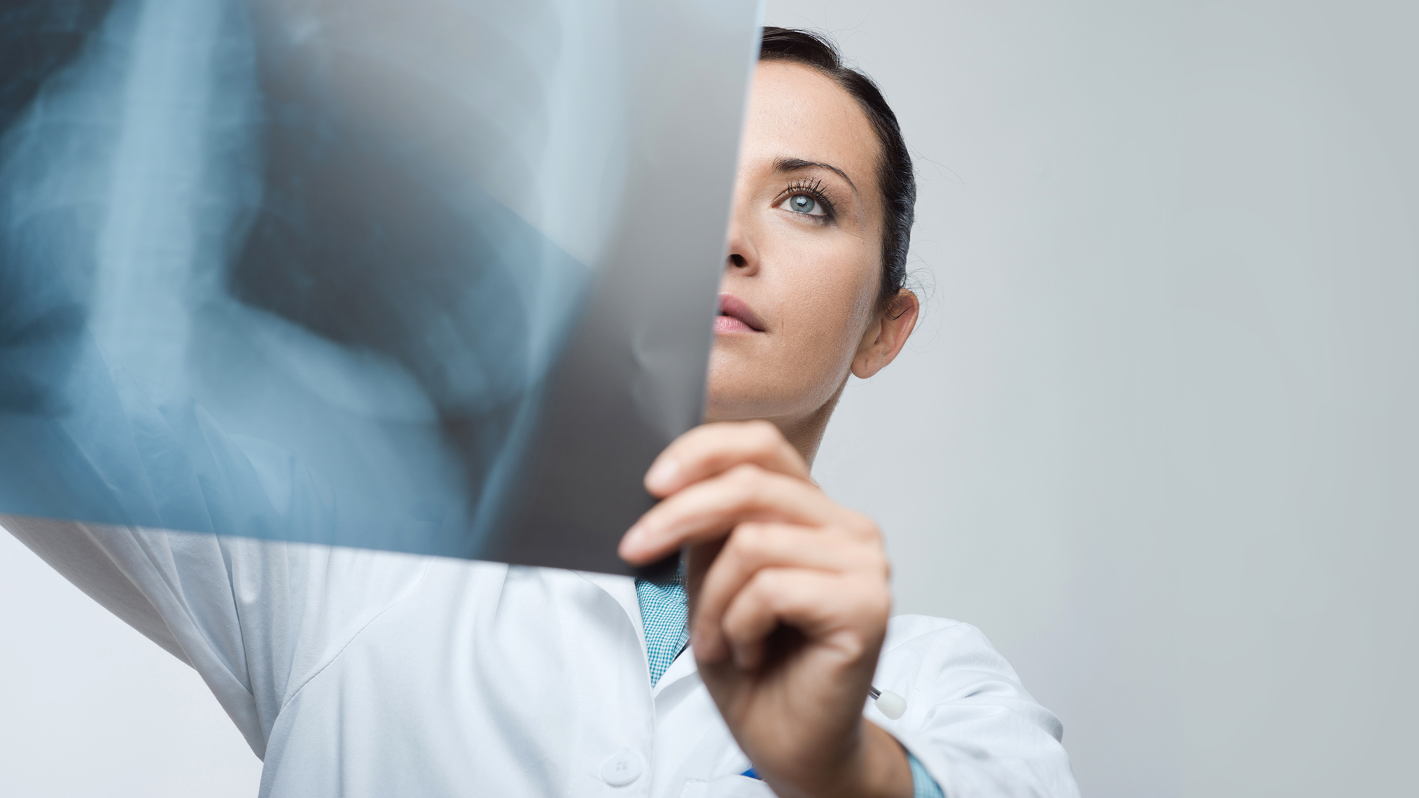 Frau untersucht Röntgenaufnahme vom Brustkorb