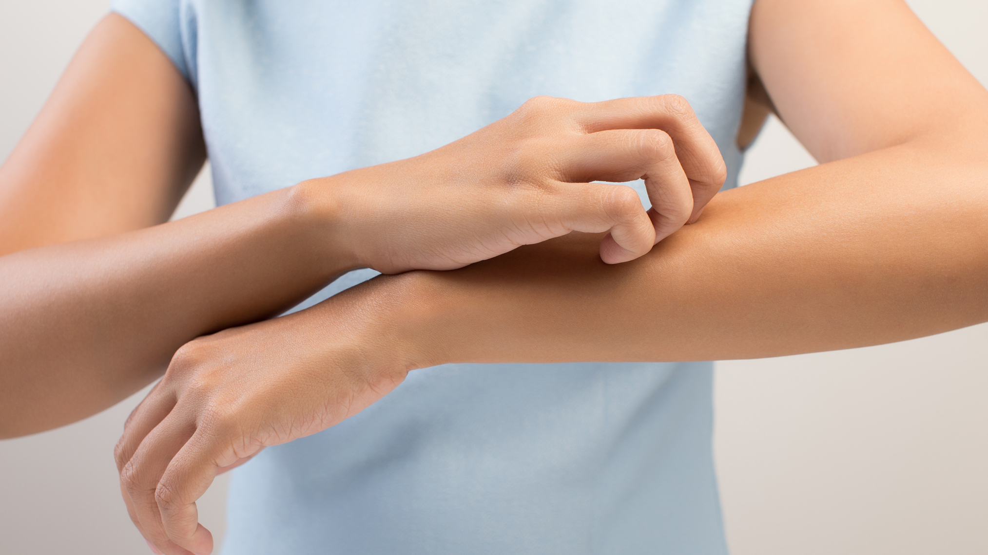 Frau kratzt sich aufgrund eines Mückenstichs am Arm